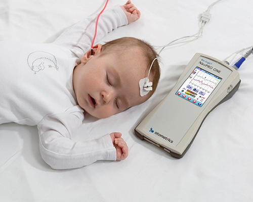 Infant undergoing ABR testing with electrode sensors and handheld device during sleep-based hearing assessment.