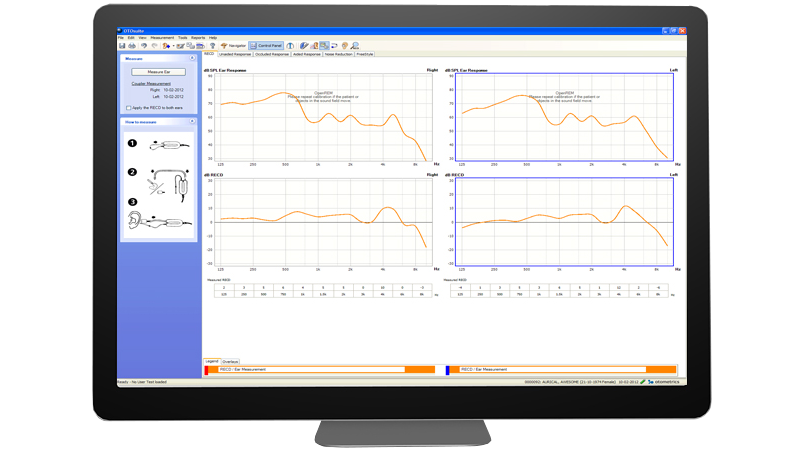 Aurical HIT software interface displaying hearing aid verification test results and RECD measurements.