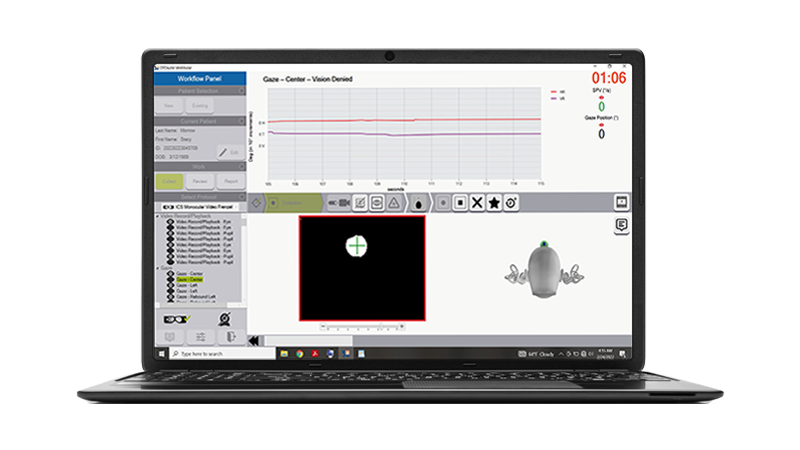 ICS Impulse software with eye tracking graph, gaze test data, and vestibular assessment interface.
