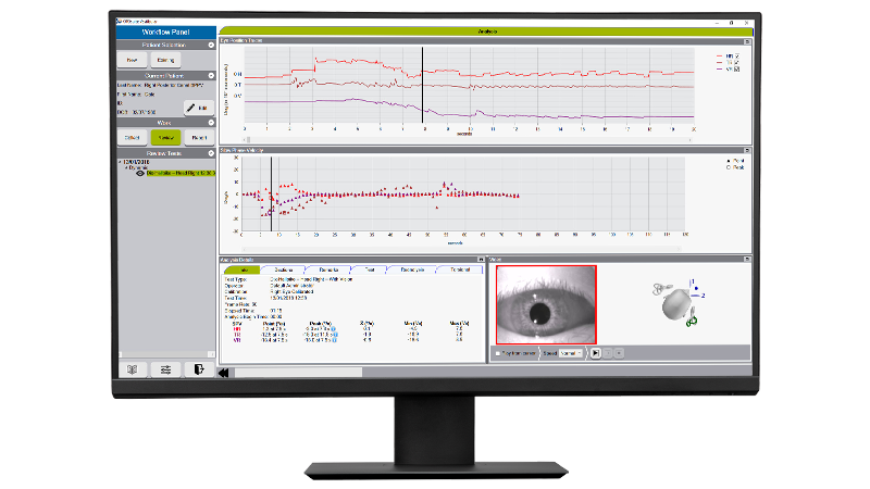 Monitor displaying ICS Impulse software with vHIT analysis graphs, real-time eye tracking, and vestibular diagnostic data.