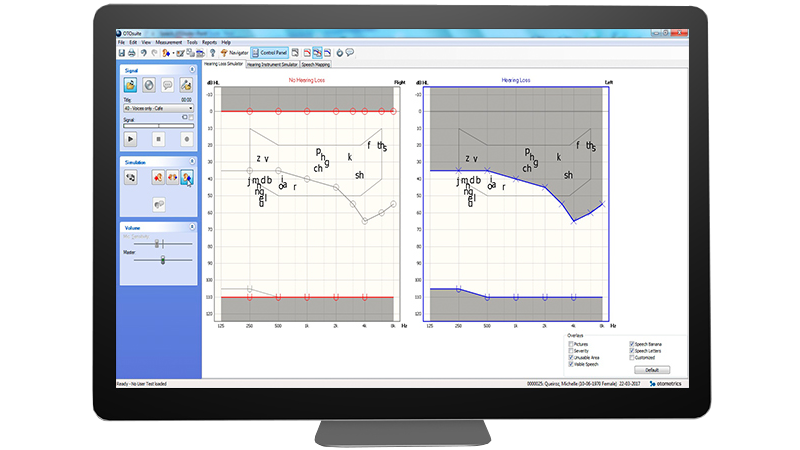 Madsen A450 audiometry software interface showing hearing loss simulation and speech mapping graph.