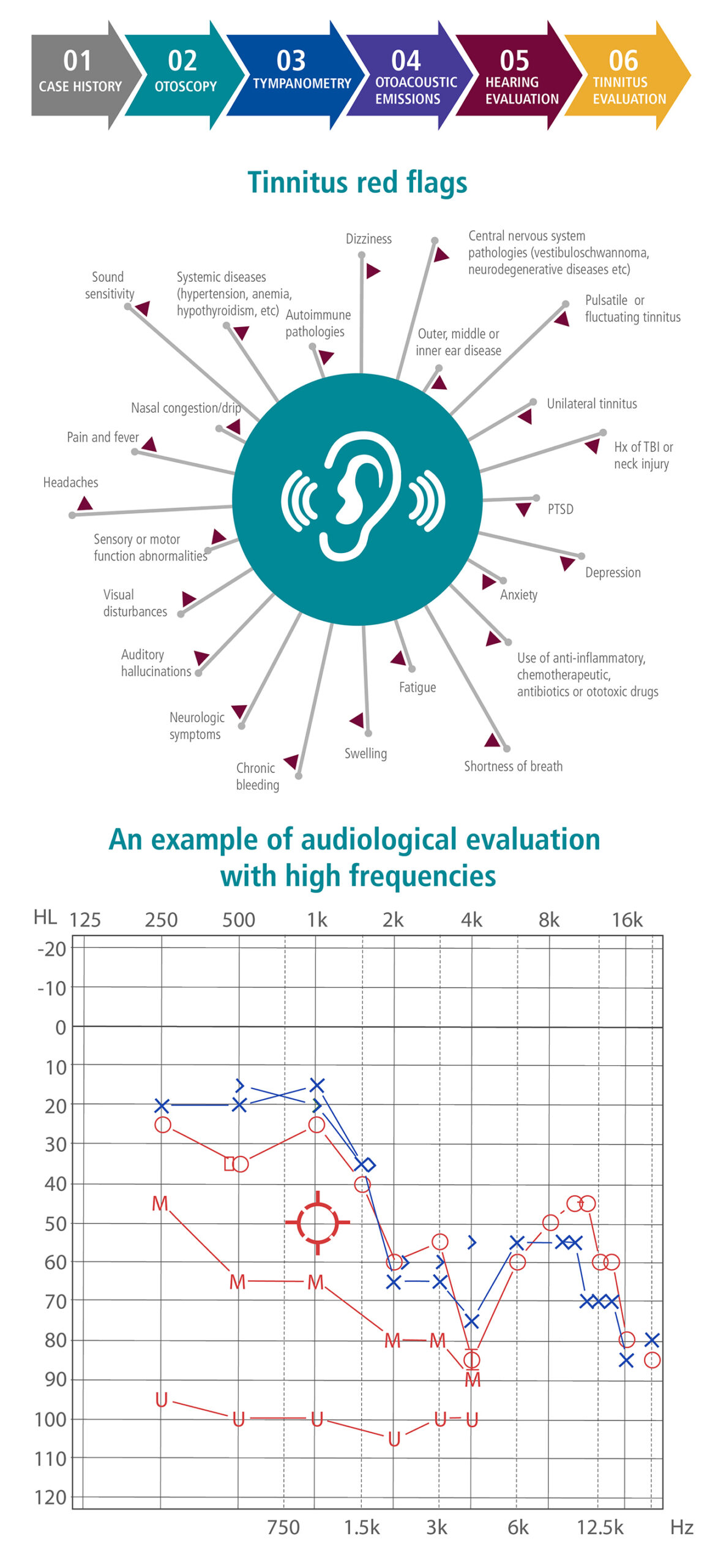 Infographic showing tinnitus red flags and an audiological evaluation chart with high-frequency hearing thresholds.