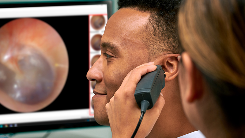 Clinician using Aurical Otocam 300 to capture high-resolution ear image during audiology exam.