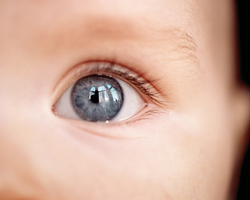 Close-up of a newborn’s eye, illustrating the importance of early detection of pediatric retinal diseases such as retinoblastoma and congenital conditions.
