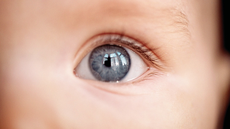 Close-up of infant eye, highlighting the focus of RetCam Envision pediatric ocular imaging.
